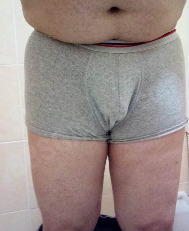 yapass3277266