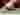 Supervalve